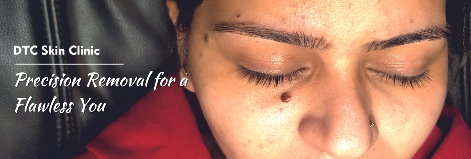 Dr. Rohit Goel skin specialist